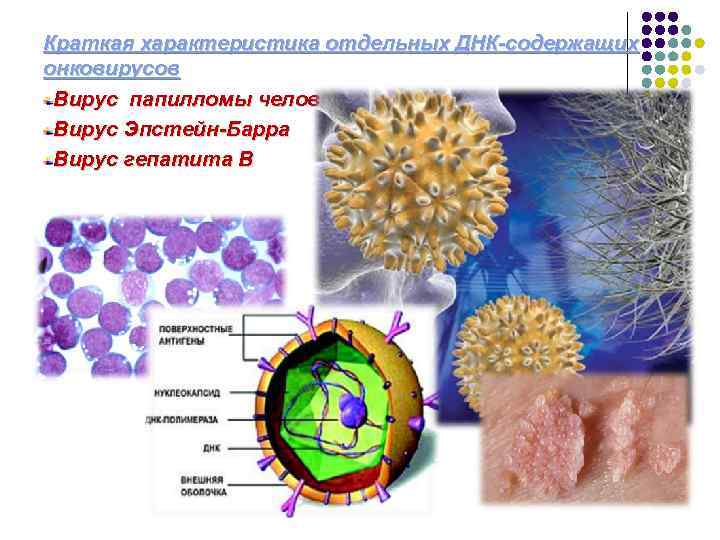 Вирус барра отзывы. Папилломавирус канцерогенез. Онковирусов. Онковирусы человека. Вирус папилломы человека и канцерогенез.