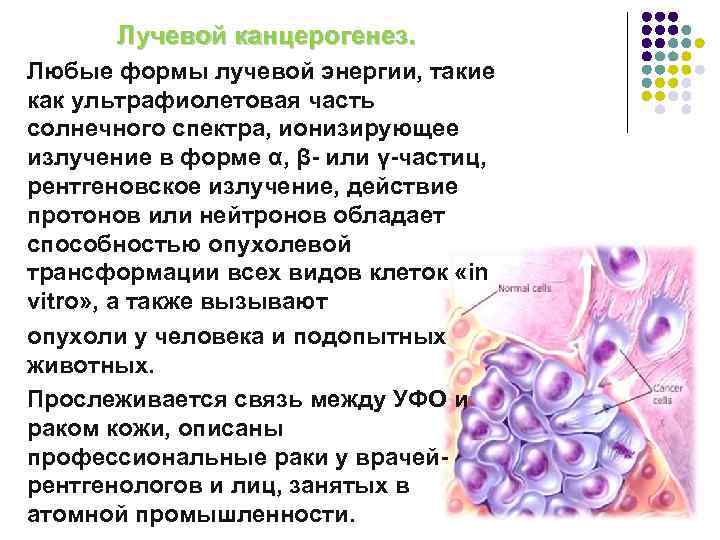Лучевой канцерогенез. Любые формы лучевой энергии, такие как ультрафиолетовая часть солнечного спектра, ионизирующее излучение