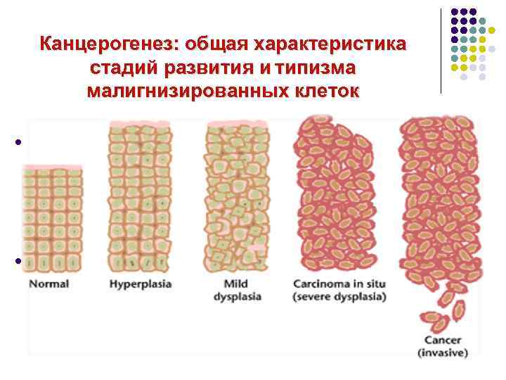 Канцерогенез: общая характеристика стадий развития и типизма малигнизированных клеток l Канцерогенез – это многоступенчатый процесс