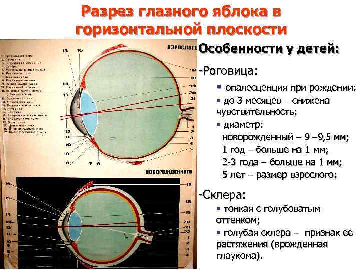Разрез глазного яблока в горизонтальной плоскости Особенности у детей: -Роговица: § опалесценция при рождении;