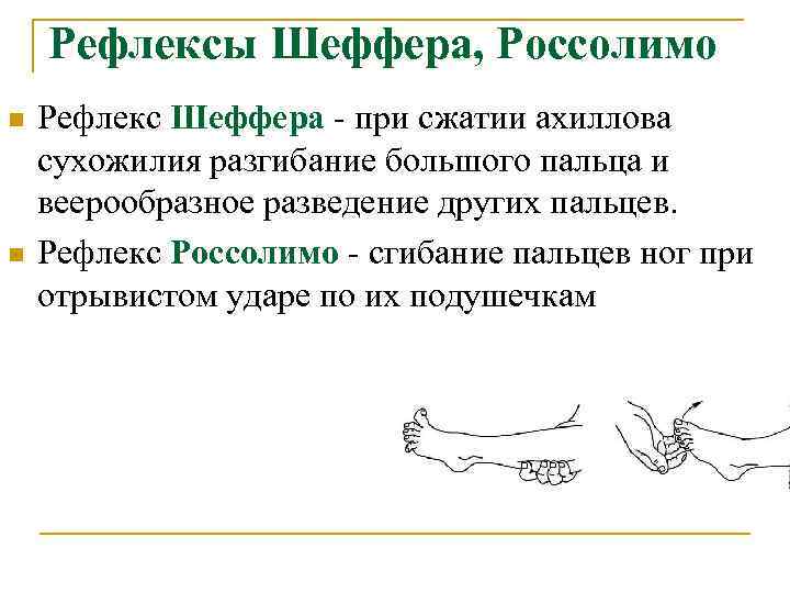 Рефлексы Шеффера, Россолимо n n Рефлекс Шеффера - при сжатии ахиллова сухожилия разгибание большого