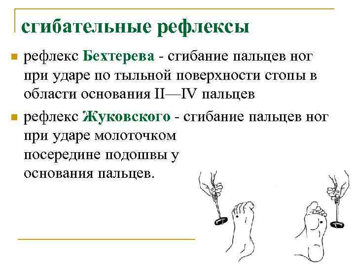 сгибательные рефлексы n n рефлекс Бехтерева - сгибание пальцев ног при ударе по тыльной