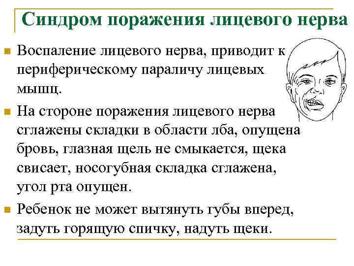 Синдром поражения лицевого нерва n n n Воспаление лицевого нерва, приводит к периферическому параличу