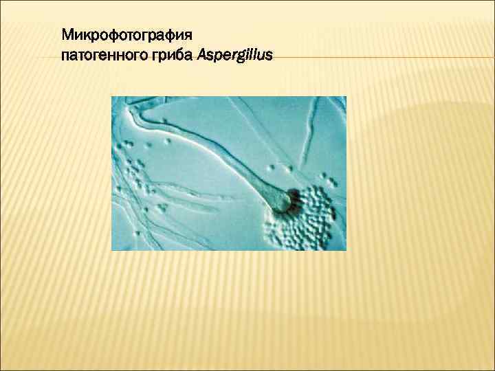 Микрофотография патогенного гриба Aspergillus 