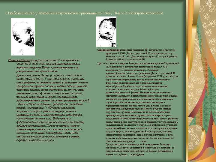 Наиболее часто у человека встречаются трисомии по 13 -й, 18 -й и 21 -й
