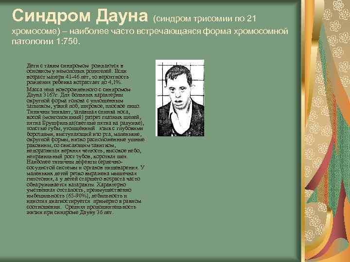 Синдром Дауна (синдром трисомии по 21 хромосоме) – наиболее часто встречающаяся форма хромосомной патологии