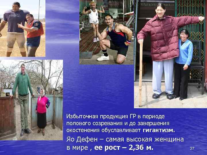  • Избыточная продукция ГР в периоде полового созревания и до завершения окостенения обуславливает