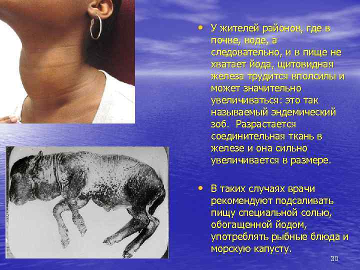  • У жителей районов, где в почве, воде, а следовательно, и в пище