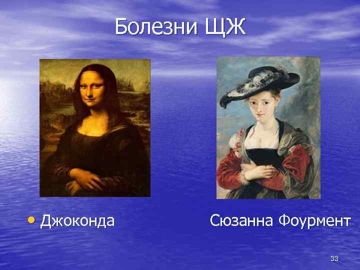 Болезни ЩЖ • Джоконда Сюзанна Фоурмент 33 