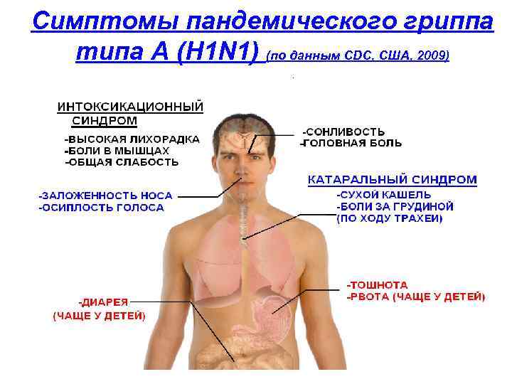 Грипп болят мышцы. Грипп h1n1 симптомы. Грипп типа а/h1n1. Симптомы гриппа. Признаки пандемии.