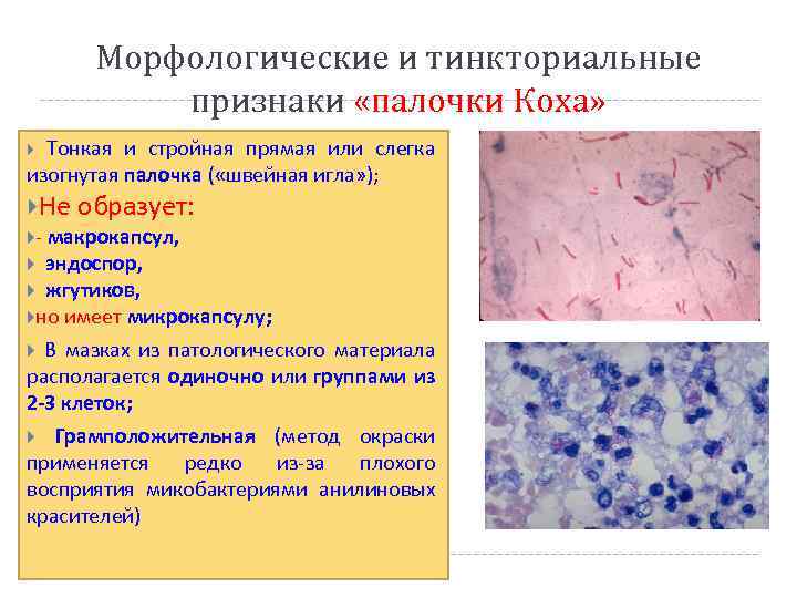 Морфологические и тинкториальные признаки «палочки Коха» Тонкая и стройная прямая или слегка изогнутая палочка