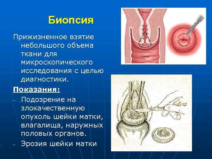 Через монитор какие обследования бывают в гинекологии