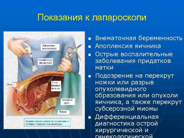 Внематочная беременность сроки. Подозрение на внематочную беременность. Яичниковая внематочная беременность. При подозрении на внематочную беременность проводят.