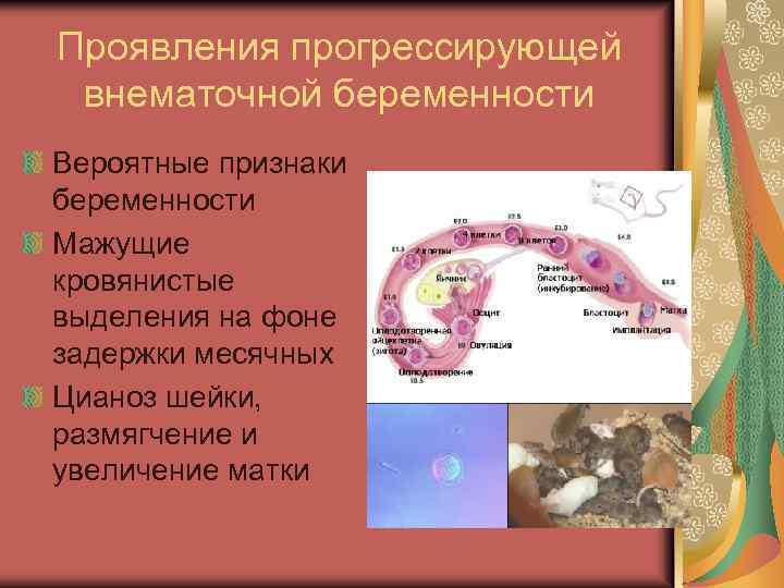 Проявления прогрессирующей внематочной беременности Вероятные признаки беременности Мажущие кровянистые выделения на фоне задержки месячных