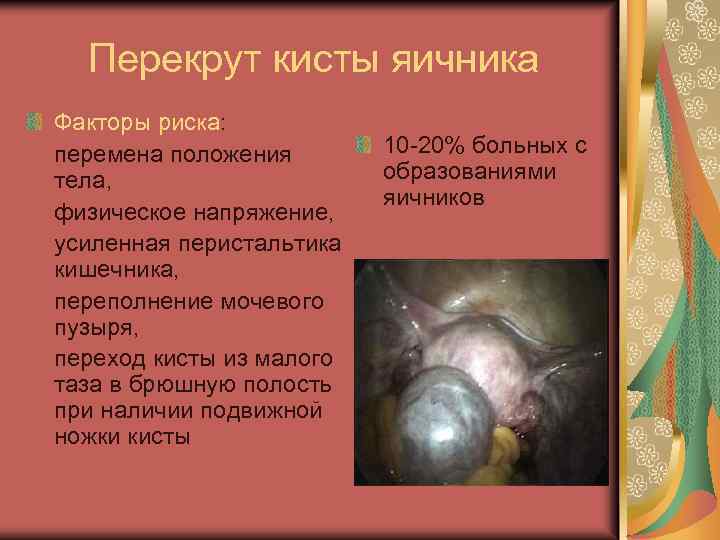 Перекрут кисты яичника Факторы риска: перемена положения тела, физическое напряжение, усиленная перистальтика кишечника, переполнение