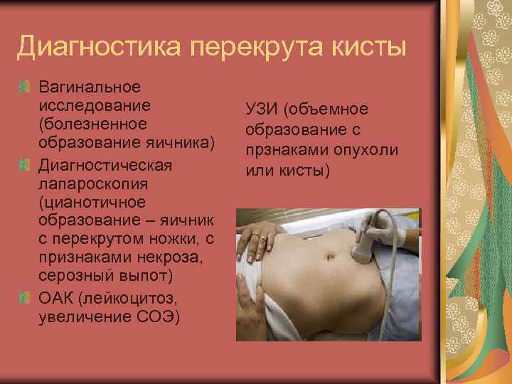 Диагностика перекрута кисты Вагинальное исследование (болезненное образование яичника) Диагностическая лапароскопия (цианотичное образование – яичник