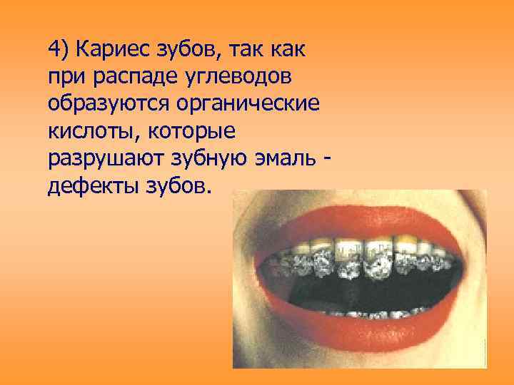 4) Кариес зубов, так как при распаде углеводов образуются органические кислоты, которые разрушают зубную