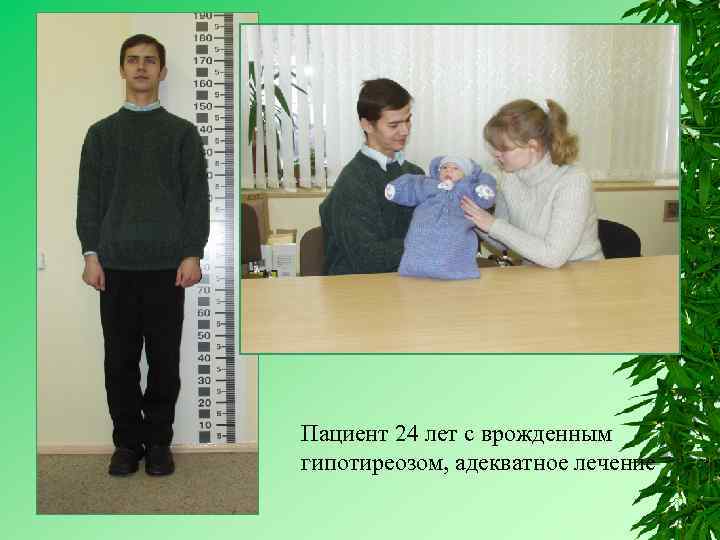 Пациент 24 лет с врожденным гипотиреозом, адекватное лечение 