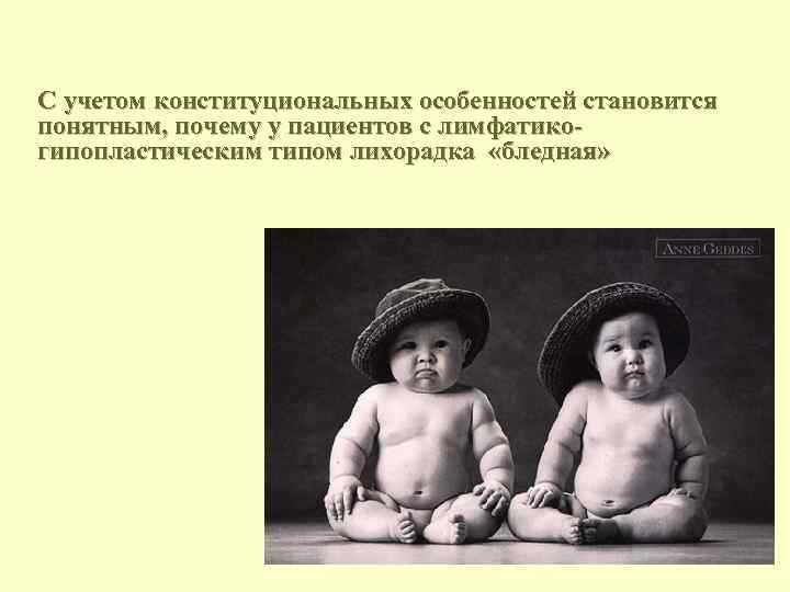 С учетом конституциональных особенностей становится понятным, почему у пациентов с лимфатикогипопластическим типом лихорадка «бледная»
