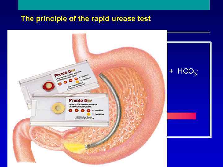 The principle of the rapid urease test NH 2 C O + 2 H