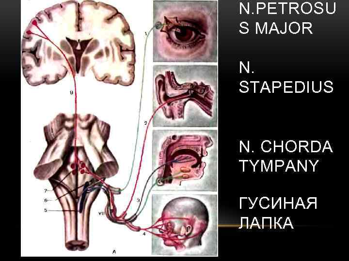 N. PETROSU S MAJOR N. STAPEDIUS N. CHORDA TYMPANY ГУСИНАЯ ЛАПКА 