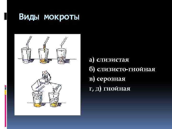 Виды мокроты а) слизистая б) слизисто-гнойная в) серозная г, д) гнойная 