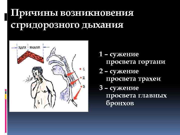 Обследование больных с заболеваниями органов дыхания презентация