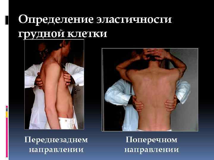 Определение эластичности грудной клетки Переднезаднем направлении Поперечном направлении 