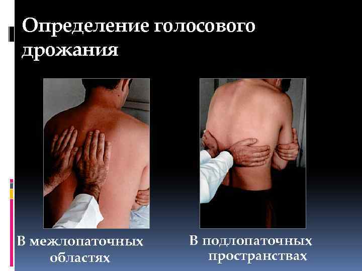 Определение голосового дрожания В межлопаточных областях В подлопаточных пространствах 