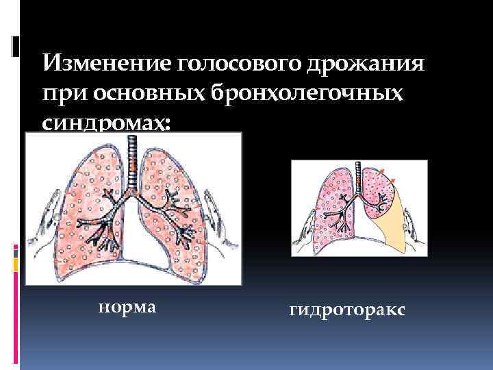 Обследование больных с заболеваниями органов дыхания презентация