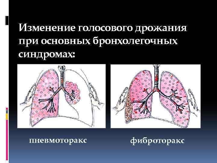 Обследование больных с заболеваниями органов дыхания презентация