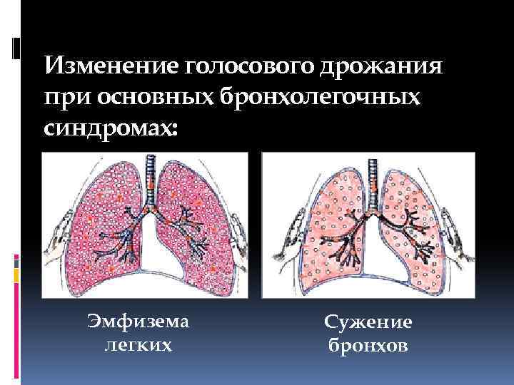 Обследование больных с заболеваниями органов дыхания презентация