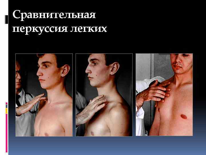 Сравнительная перкуссия легких 