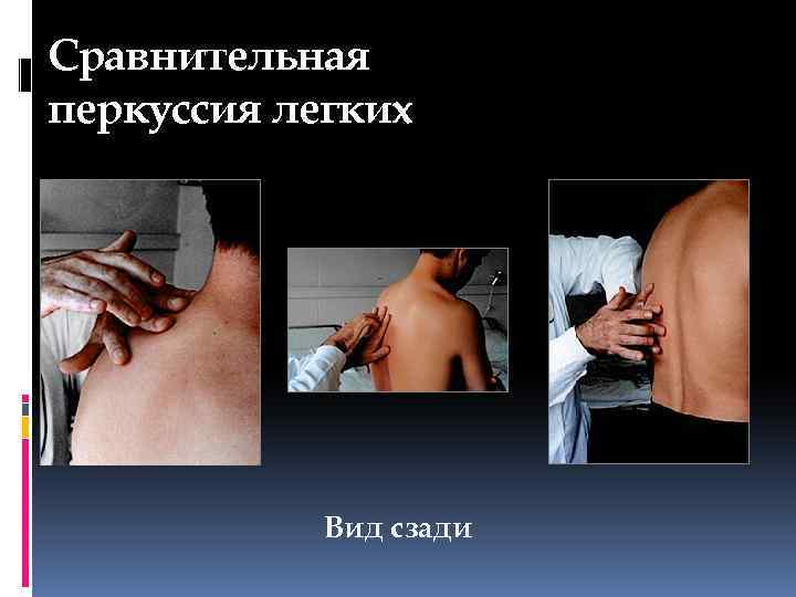 Сравнительная перкуссия легких Вид сзади 