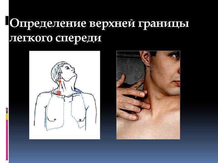 Определение верхней границы легкого спереди 