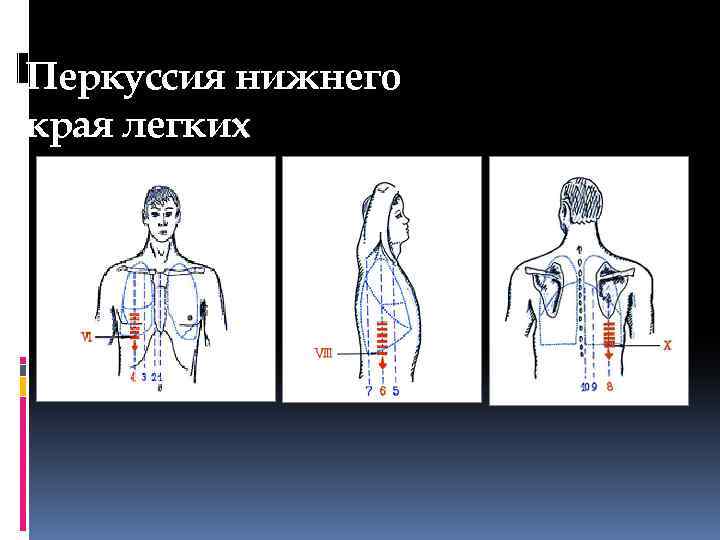 Перкуссия нижнего края легких 