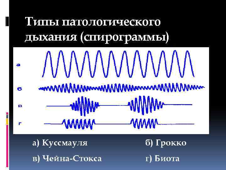Типы патологического дыхания (спирограммы) а) Куссмауля б) Грокко в) Чейна-Стокса г) Биота 