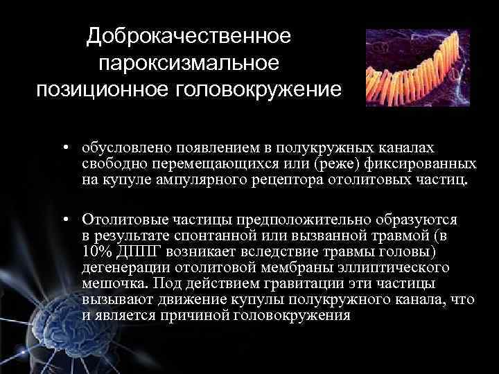 Доброкачественное пароксизмальное позиционное головокружение • обусловлено появлением в полукружных каналах свободно перемещающихся или (реже)