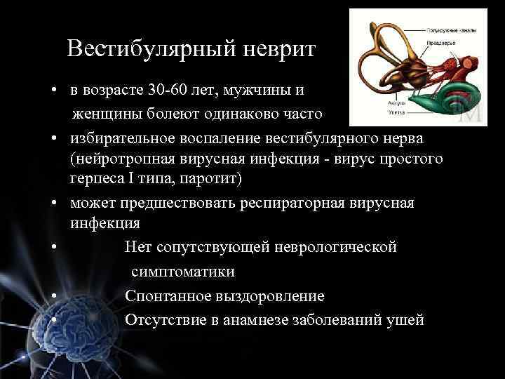 Вестибулярный неврит • в возрасте 30 -60 лет, мужчины и женщины болеют одинаково часто