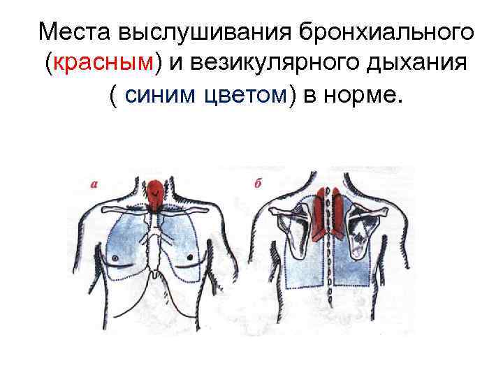 Места выслушивания бронхиального (красным) и везикулярного дыхания ( синим цветом) в норме. 