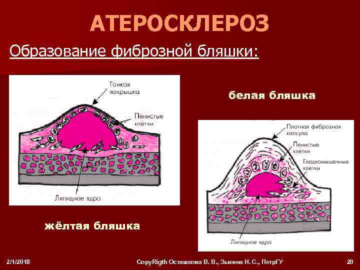 Схема строения пейеровой бляшки