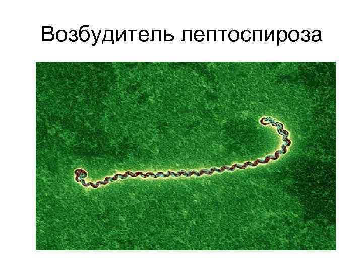 Возбудитель лептоспироза 