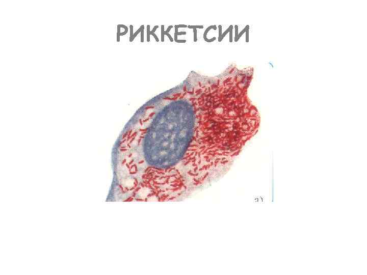 РИККЕТСИИ 