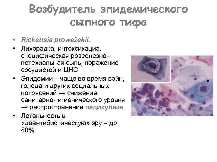 Возбудитель эпидемического сыпного тифа • Rickettsia prowažekii. • Лихорадка, интоксикациа, специфическая розеолезнопетехиальная сыпь, поражение
