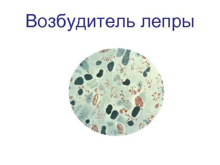 Возбудитель лепры 