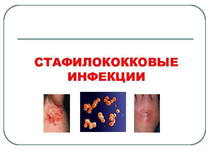 СТАФИЛОКОККОВЫЕ ИНФЕКЦИИ 