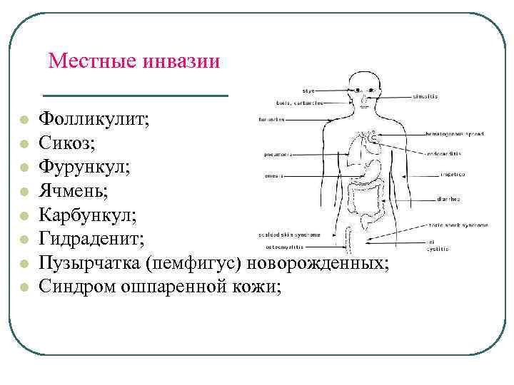 Местные инвазии l l l l Фолликулит; Сикоз; Фурункул; Ячмень; Карбункул; Гидраденит; Пузырчатка (пемфигус)