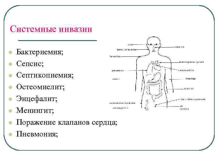 Системные инвазии l l l l Бактериемия; Сепсис; Септикопиемия; Остеомиелит; Энцефалит; Менингит; Поражение клапанов