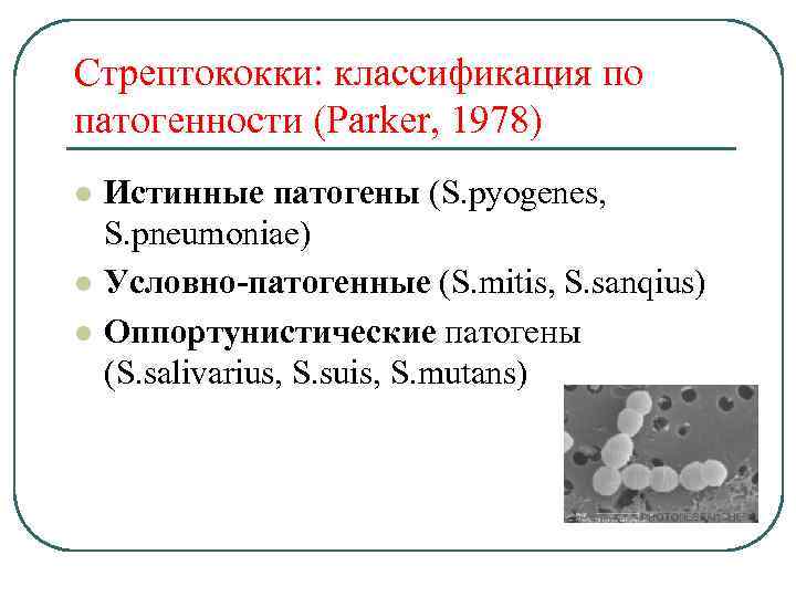 Стрептококки у женщин лечение. Стрептококки классификация микробиология. Streptococcus pyogenes факторы патогенности. Гемолитический стрептококк классификация. Стрептококк пиогенес классификация.