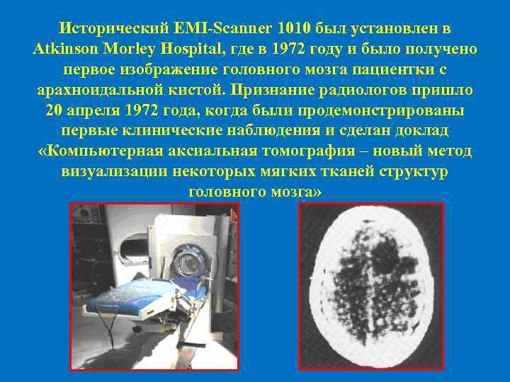 Исторический EMI-Scanner 1010 был установлен в Atkinson Morley Hospital, где в 1972 году и